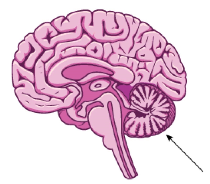 Which brain structure is identified by the arrow in the figure? A. Cerebellum B. Medulla-example-1