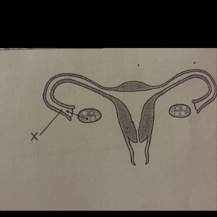 State one way a complete blockage at location X would affect the reproductive process-example-1