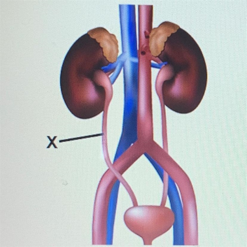 The picture represents the excretory system, Which is represented by the X? nephron-example-1