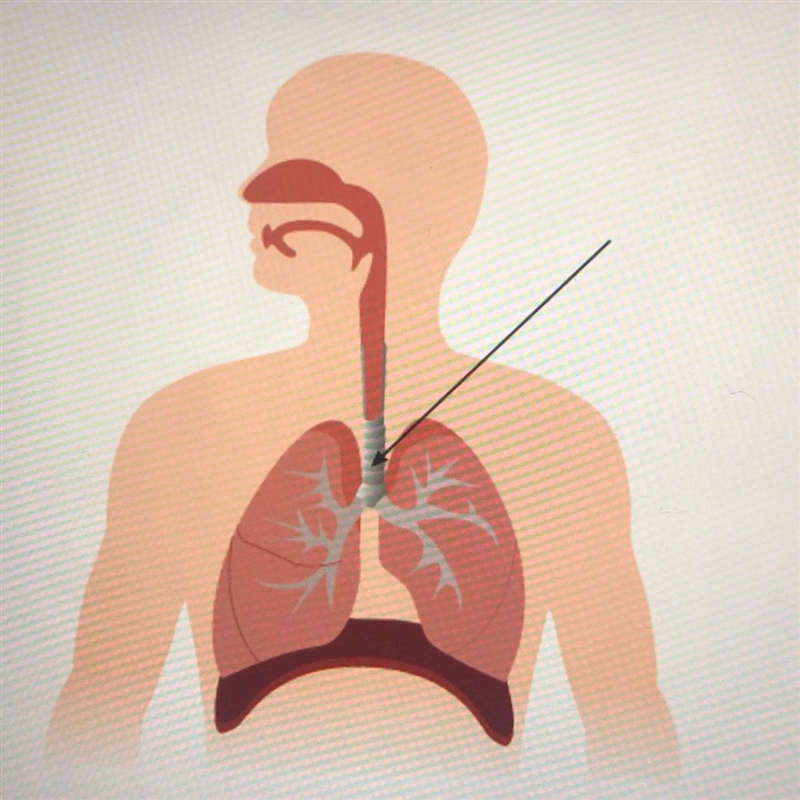 The structure identified in the image above is called the A. bronchioles B. alveoli-example-1