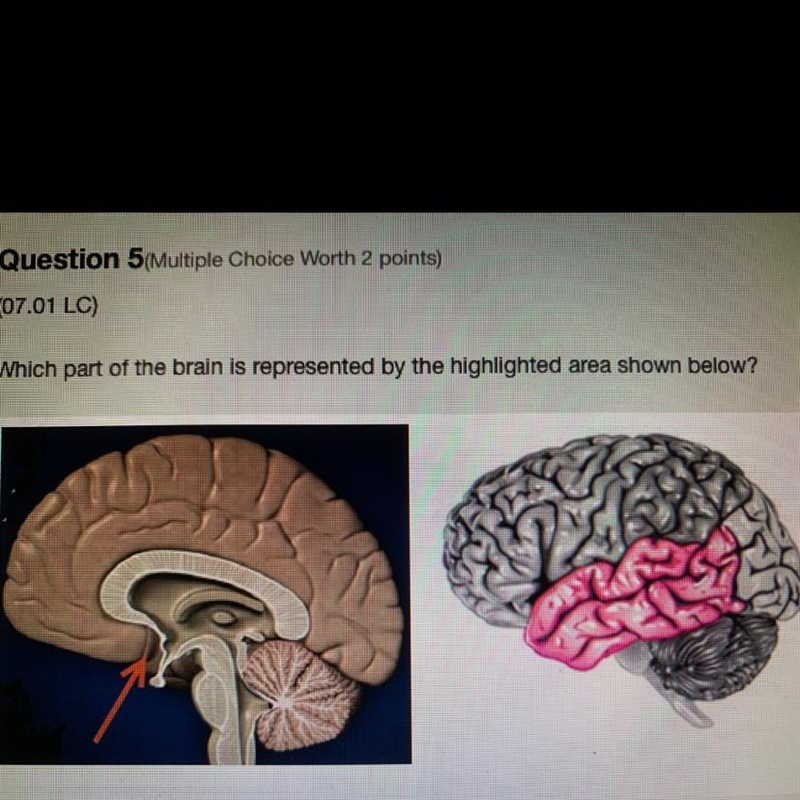 Which part of the brain is represented by the highlighted areas shown below? A.Occipital-example-1