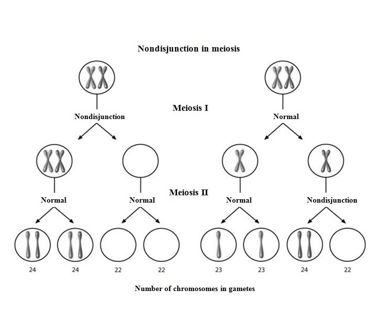 The table above shows five different types of chromosomal abnormalities that can occur-example-1