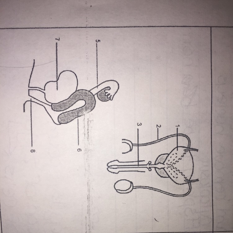 Name the structures labeled in the diagrams ! Please answer this !!-example-1