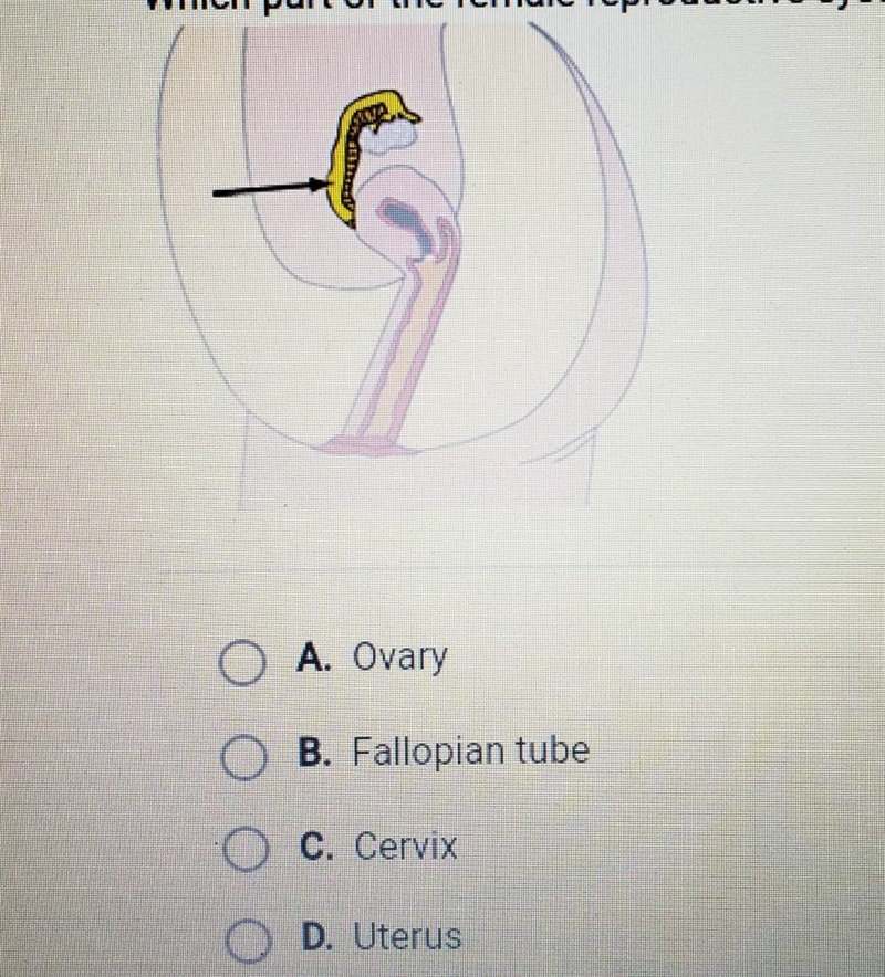 Which part of the female reproductive system is highlighted below?​-example-1