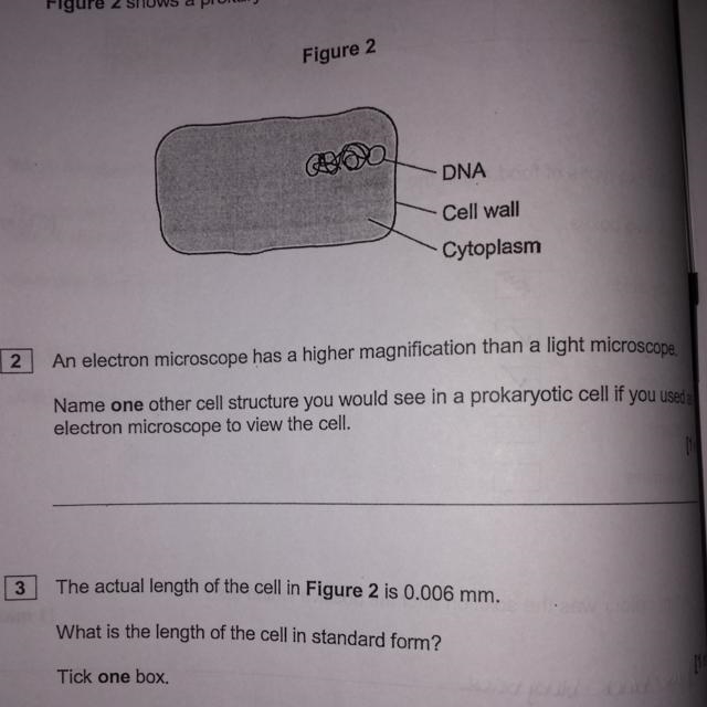 Name one other cell structure you would see in a prokaryotic cell if you used an electron-example-1