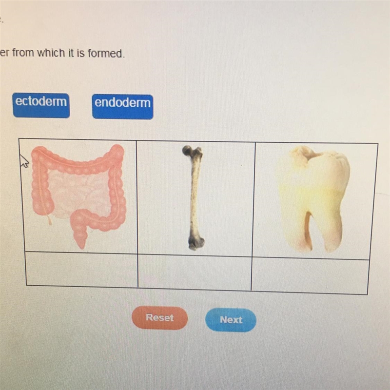 Match each organ with the germ layer from which it is formed. mesoderm ectoderm endoderm-example-1