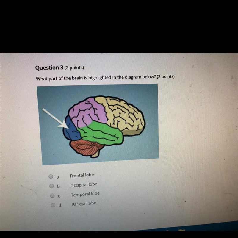 What Part Of The Brain is Highlighted In The Diagram Below-example-1