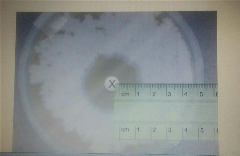 What is the zone of inhibition in the image shown? A) 1.1 cm B) .1 meters C) 1.1 mm-example-1