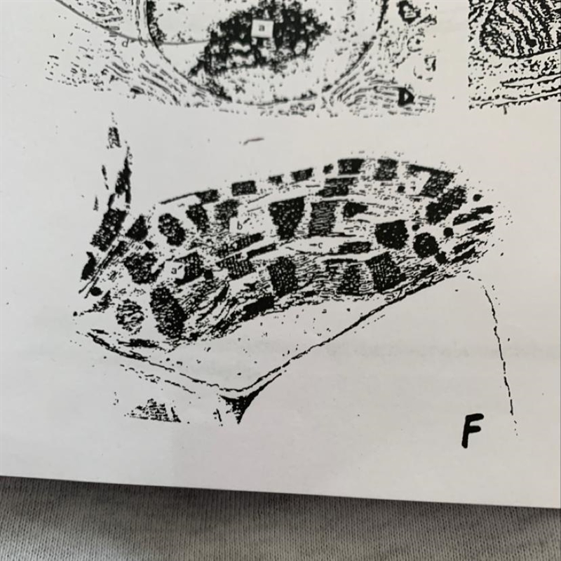 NAME that ORGANELLE!!!! please...-example-1