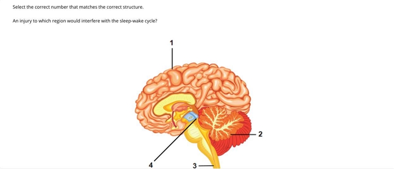 An injury to which region would interfere with the sleep-wake cycle?-example-1