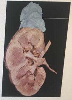 What is secreted by the medulla of the highlighted structure? What is secreted by-example-1