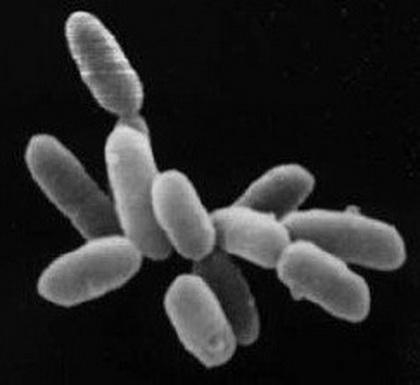 Kingdom Archaebacteria includes many types of bacteria. Which organisms are found-example-1