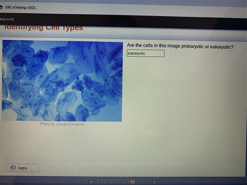 Are the cells in this image prokaryotic or eukaryotic-example-1