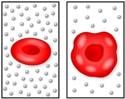 The image on the left shows a normal red blood cell, and the image on the right shows-example-1