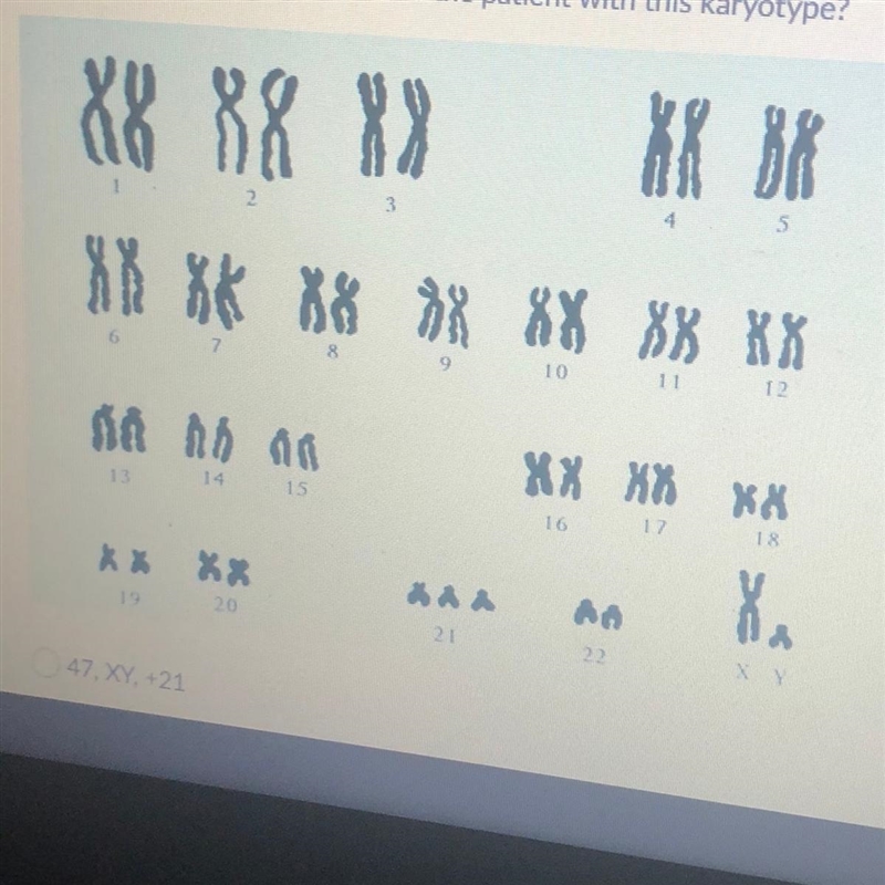 Which notation correctly describes the patient with this karyotype?-example-1