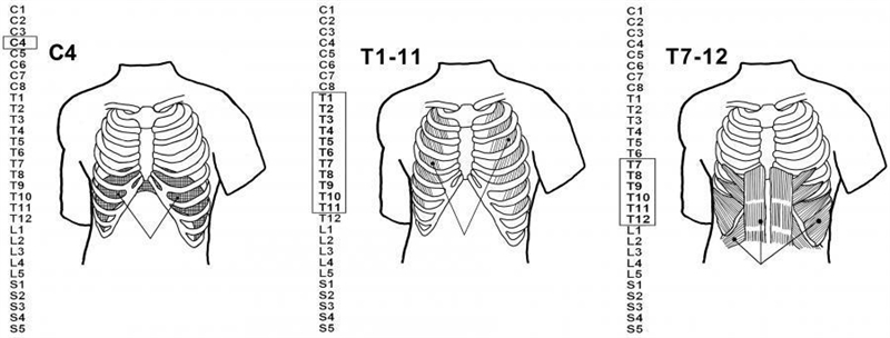 The emergency department is awaiting the arrival of a spinal cord-injured patient-example-1