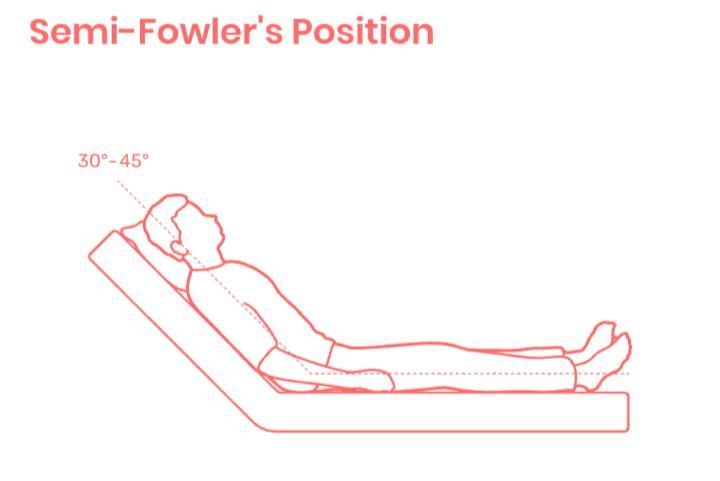 A woman comes to the emergency department reporting vaginal discharge and pelvic pain-example-1