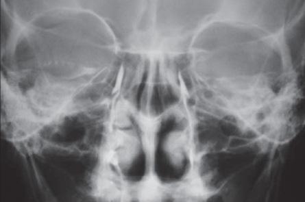 a patient comes to the ophthalmologist’s office complaining of excess tearing. the-example-1