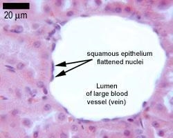 Simple squamous epithelium is a stacked, double layer of cells is a single layer of-example-1