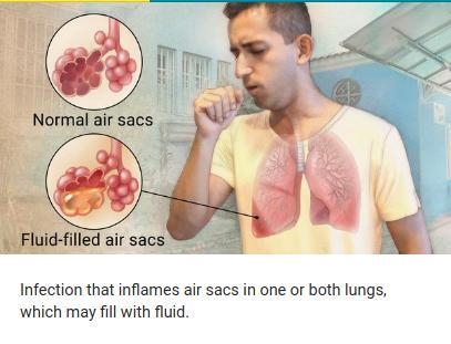 which disease causes an inflammation of the lungs A. mononucleosis B. pneumonia C-example-1