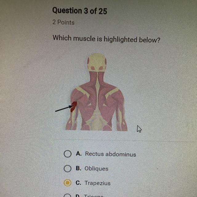 Which muscle is highlighted below?-example-1