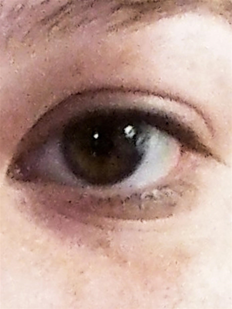 Can you help me determine eye type?​-example-1