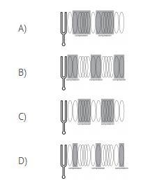 Which diagram correctly identifies the compressions in a longitudinal sound wave?-example-1