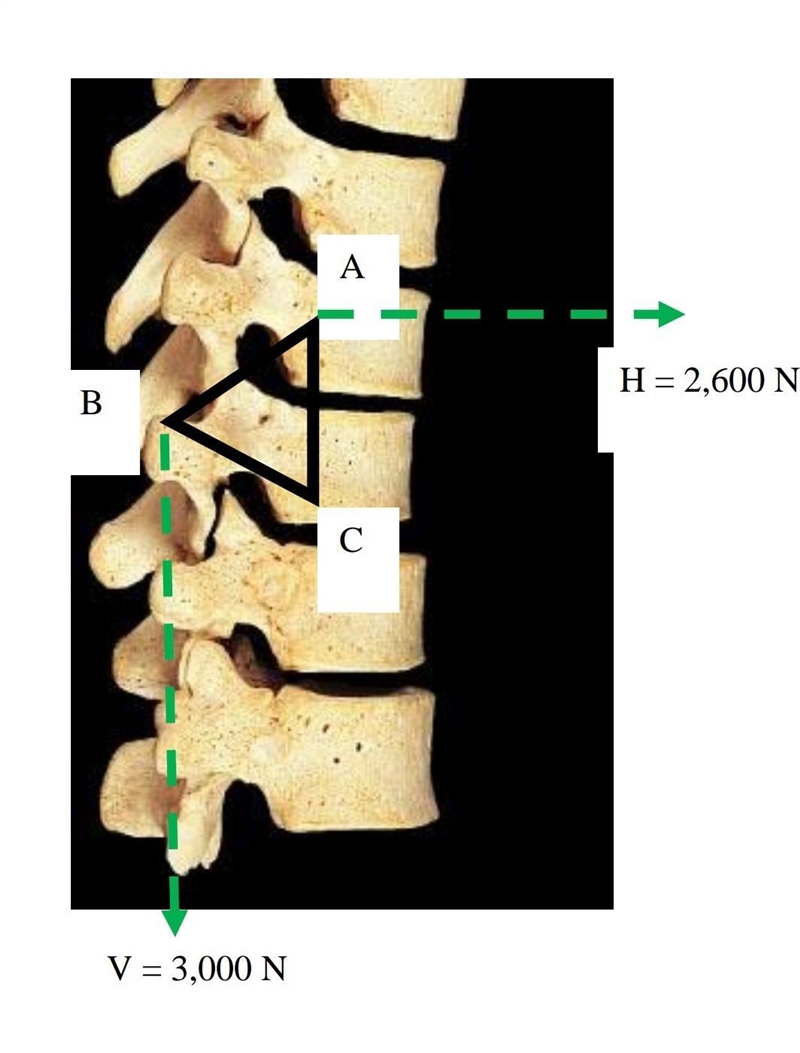 Three struts are pinned together at A, B, and C to form a triangular implant which-example-1