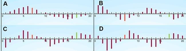 Which acceleration graph corresponds to the pressure graph shown? A. Graph A B. Graph-example-1