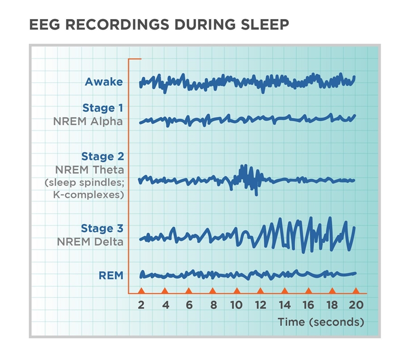 If the EEG record reveals evidence of very small and very fast waves in a person that-example-1