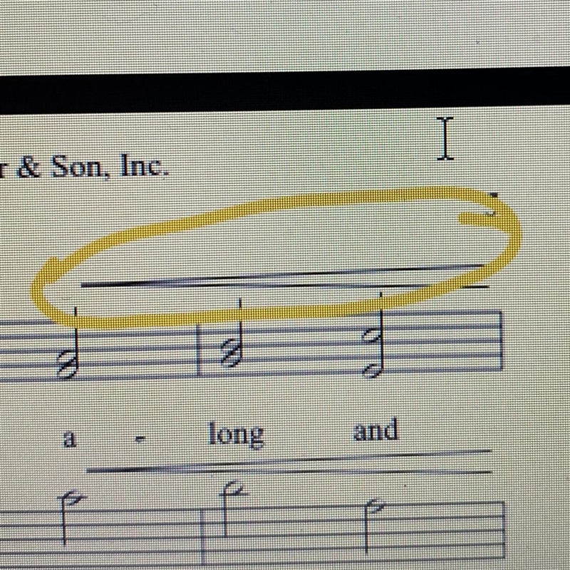 What is this musical symbol called?-example-1