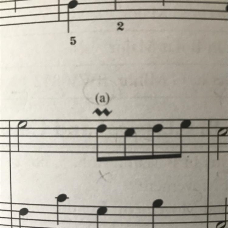 What is this symbol called in music?-example-1