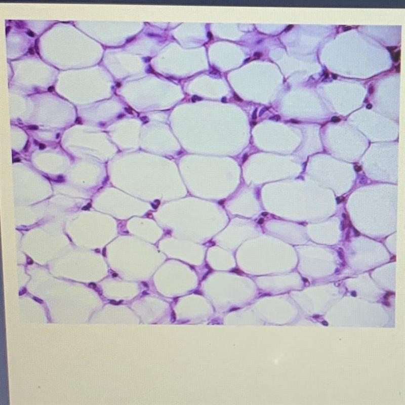 Which level of organization is pictured? A. cell B. tissue C. organ D. organ system-example-1