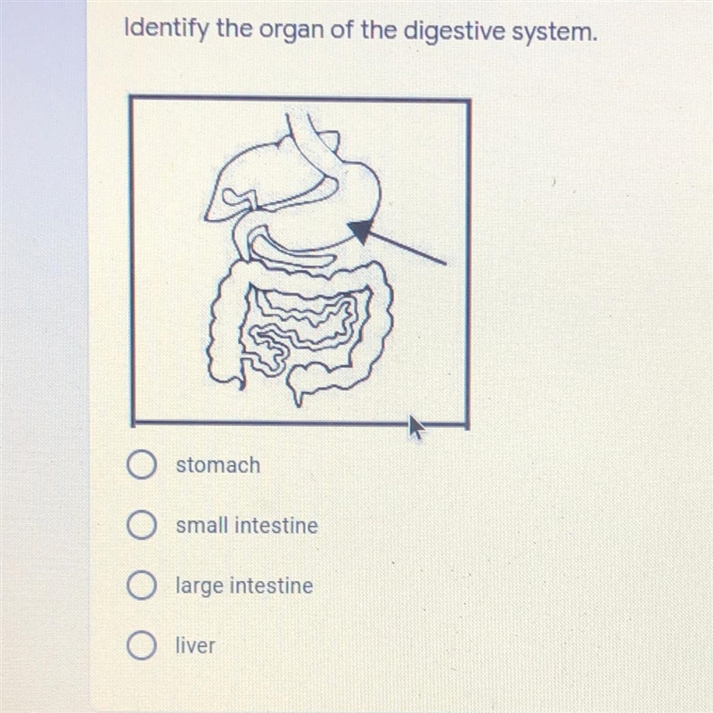 Identify the organ of the digestive system. A)stomach B)small intestine C)large intestine-example-1