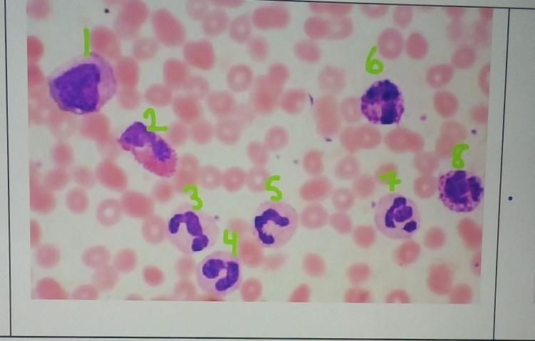 I really need help. to identify which one(s) are neutrophil, eosinophil, basophil-example-1