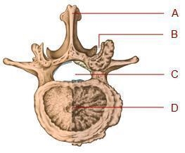 Where is the foramen in this diagram of a bone from the vertebral column? A. option-example-1