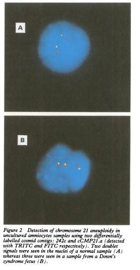 If a centromere probe is used in FISH analysis how many spots will light up in the-example-1