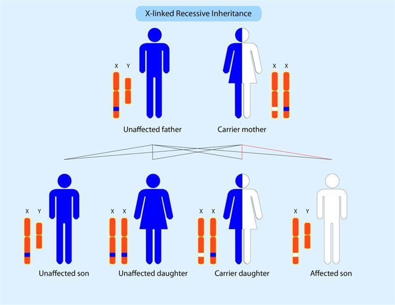 One type of muscular dystrophy, Duchenne muscular dystrophy, is is an inherited condition-example-1