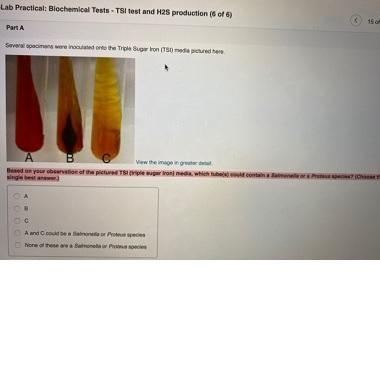 Based on your observation of the pictured TSI (triple sugar iron) media, which tube-example-1