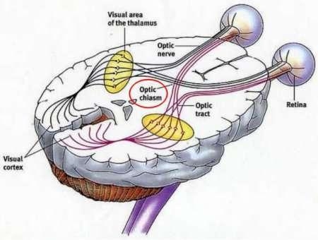 In the cranial nerve model, which best describes the location of the optic chasma-example-1