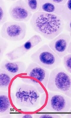 In what stage of mitosis is this cell going through?​-example-1