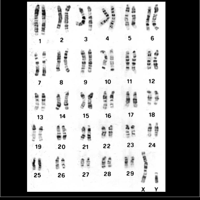 What is the diploid & haploid number?-example-1