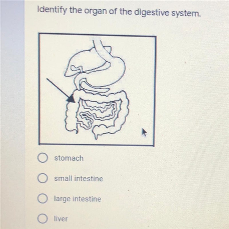 Identify the organ of the digestive system. A)stomach B)small intestine C)large intestine-example-1