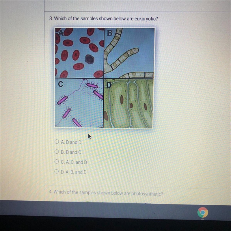 3. Which of the samples shown below are eukaryotic? • A. B and D • B. B and C • C-example-1