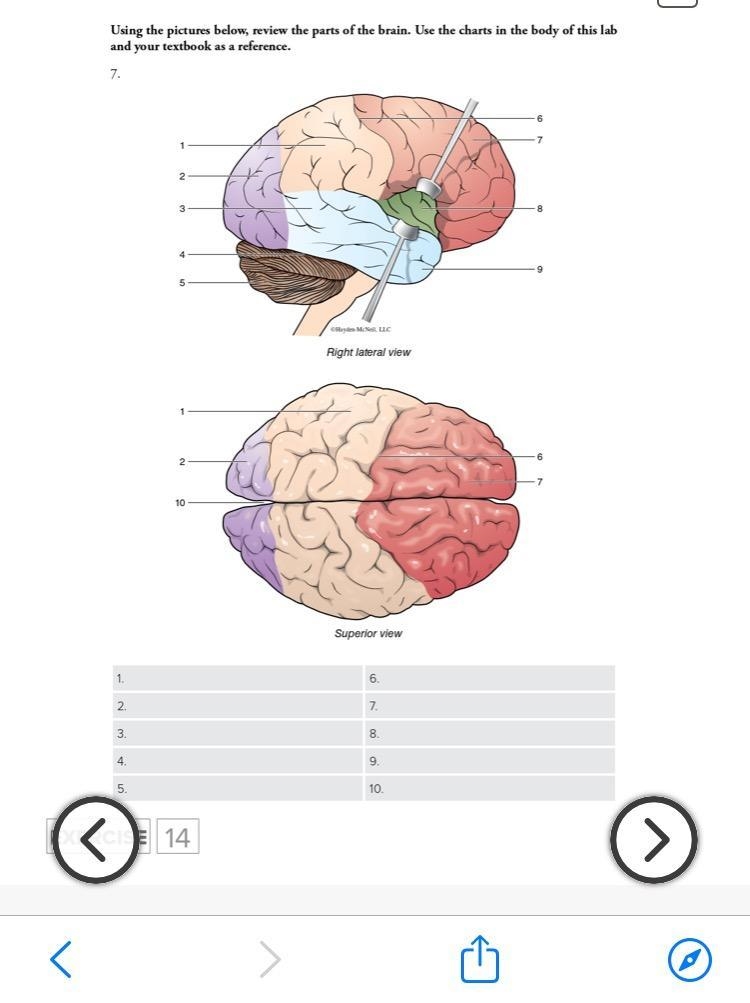 I need help with anatomy-example-1