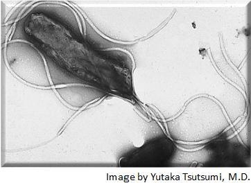 What is shown in the image? (please don't guess. I really need help) prokaryote eukaryote-example-1