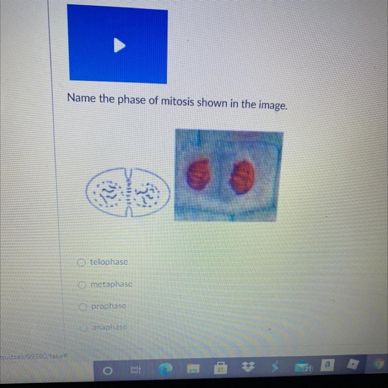 Name the phase of mitosis-example-1