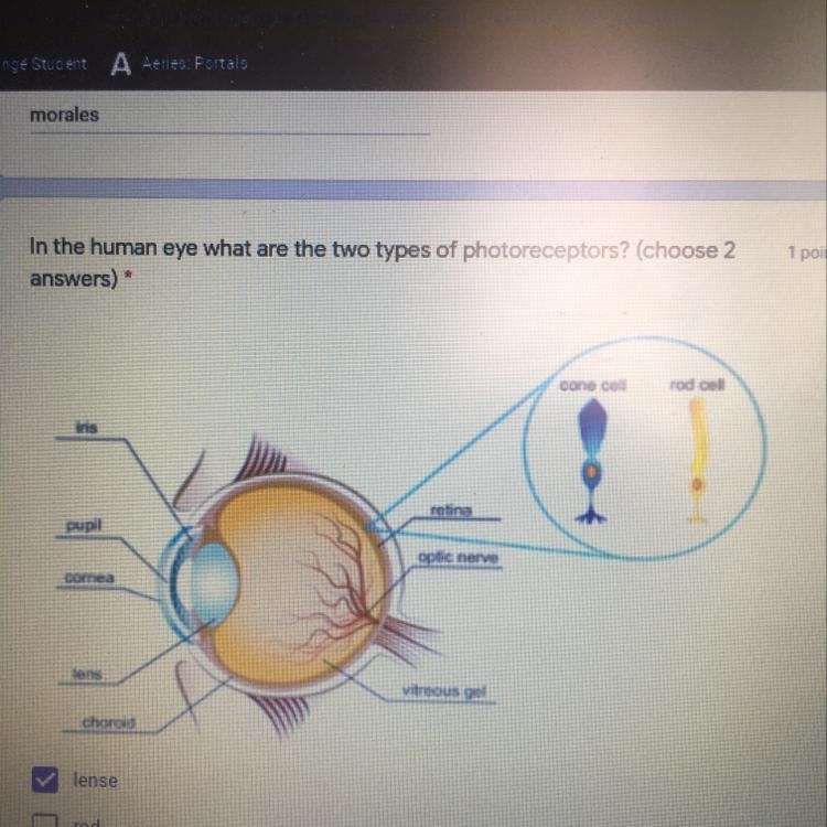 In the human eye what are the two types of photoreceptors? (choose 2 Answers) lense-example-1