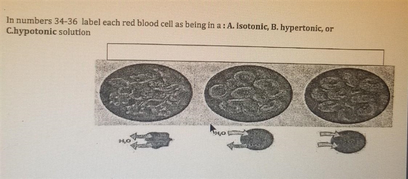 In numbers 34-36 label each red blood cell as being in a: A. isotonic, B. hypertonic-example-1