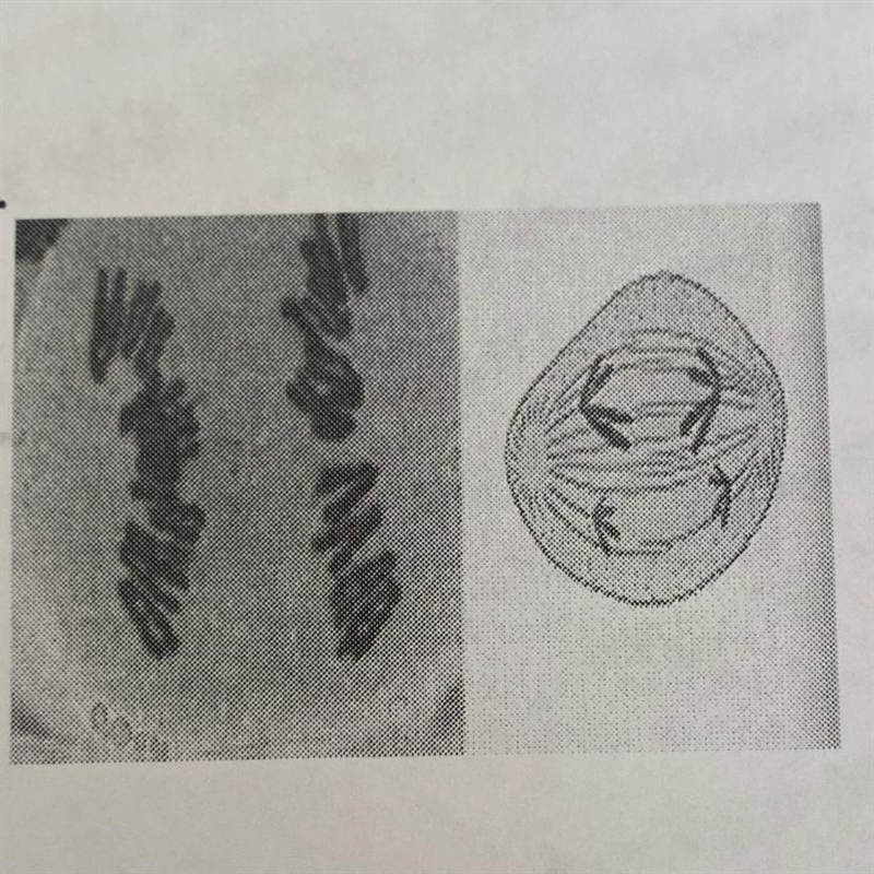 What Phase is This Cell in? Interphase Prophase Metaphase Anaphase Telophase Prophase-example-1